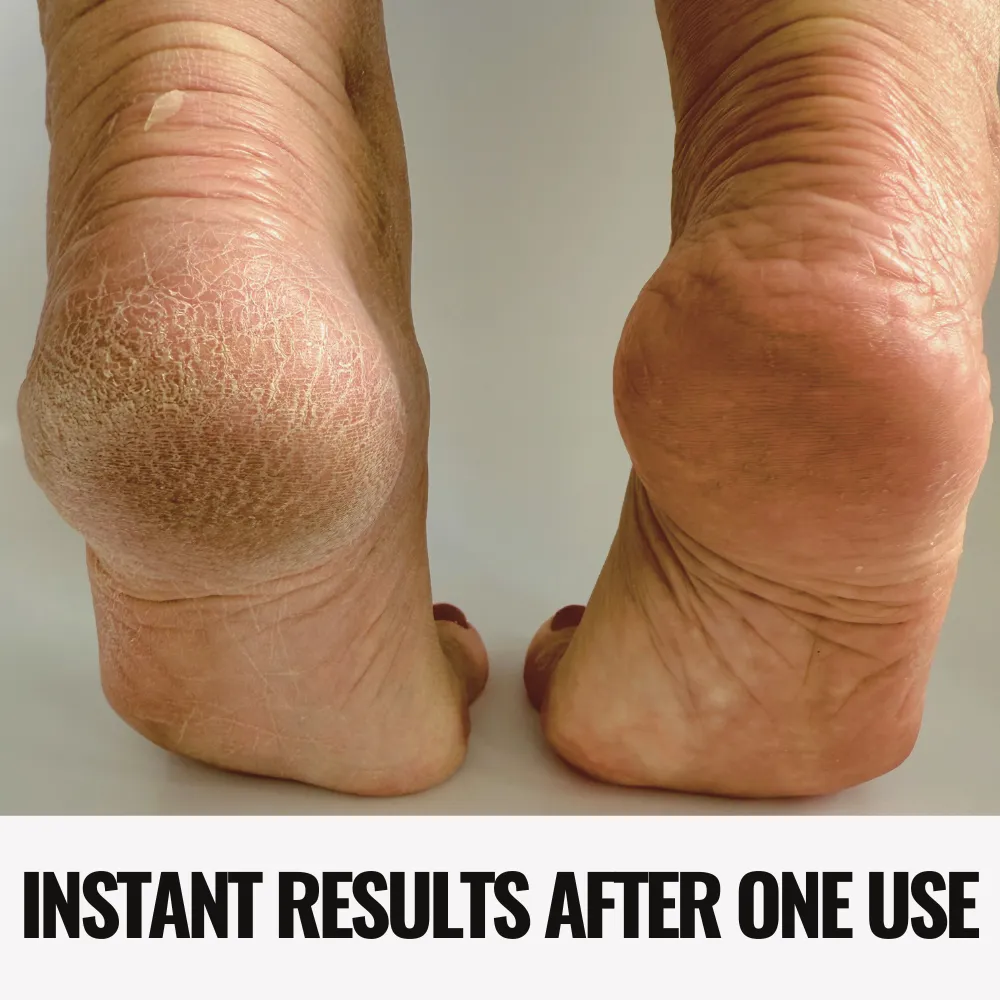Foot File & Heel Polish Duo