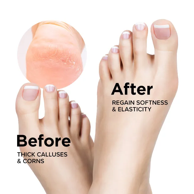 (NEW) Freeman Flirty Feet Cracked Heel Foot Treatment Neem Oil & Shea Butter 100ml